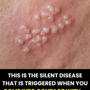 What few people know about this silent disease that can appear without warning