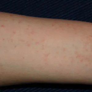 Benefits of Yoga for Flexibility: A Complete Guide to Improving Mobility and Muscle Elasticity