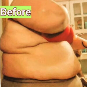 Lexi Reed’s Inspiring Transformation: From Battling a Rare Disease at 485 Pounds to Rocking a Swimsuit with Confidence