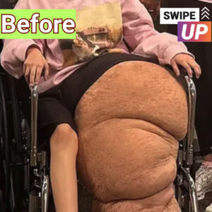 Florida Teen Jasmine Ramirez, 14, Undergoes 17-Hour Surgery to Amputate 174-Lb Leg, Family Shares Her “Journey of Strength”