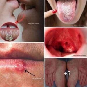 These are the signs that he is cr… See more