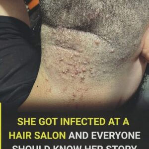 Haircut Health Warning: The Infection You Can Catch at the Salon and How to Stay Safe