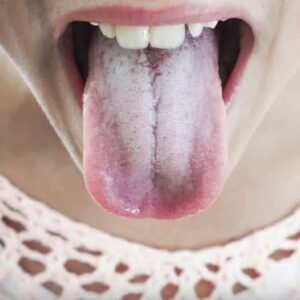 Listen to Your Tongue: 11 Subtle Health Messages It Sends