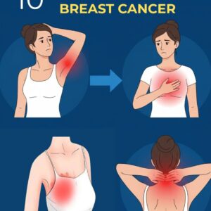 10 Warning Signs of Breast Cancer You Should Never Ignore