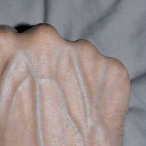 If Your Hand Veins Are Bulging or More Noticeable, Don’t Ignore These Possible Causes