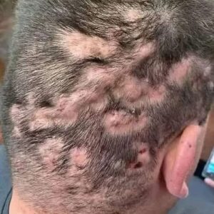 These are the first symptoms of cr…
