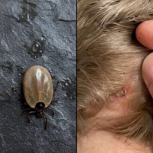 How to stay calm when you find unwanted “guests” in your child’s hair.