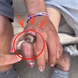 She promised never to take off his wedding ring… and ended up losi…See more