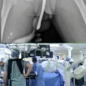 News Hospitalized After Risky Experiment