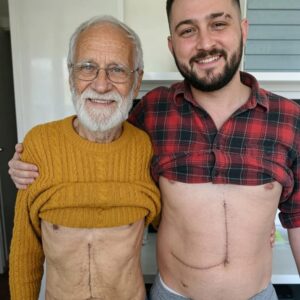 Understanding the Risks and Rewards of Living Liver Donation