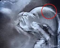Doctors couldn’t believe what they saw during the ultrasound